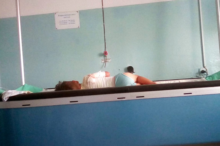 Подожжённый сверстниками мальчик перенёс ещё одну операцию в Таразе